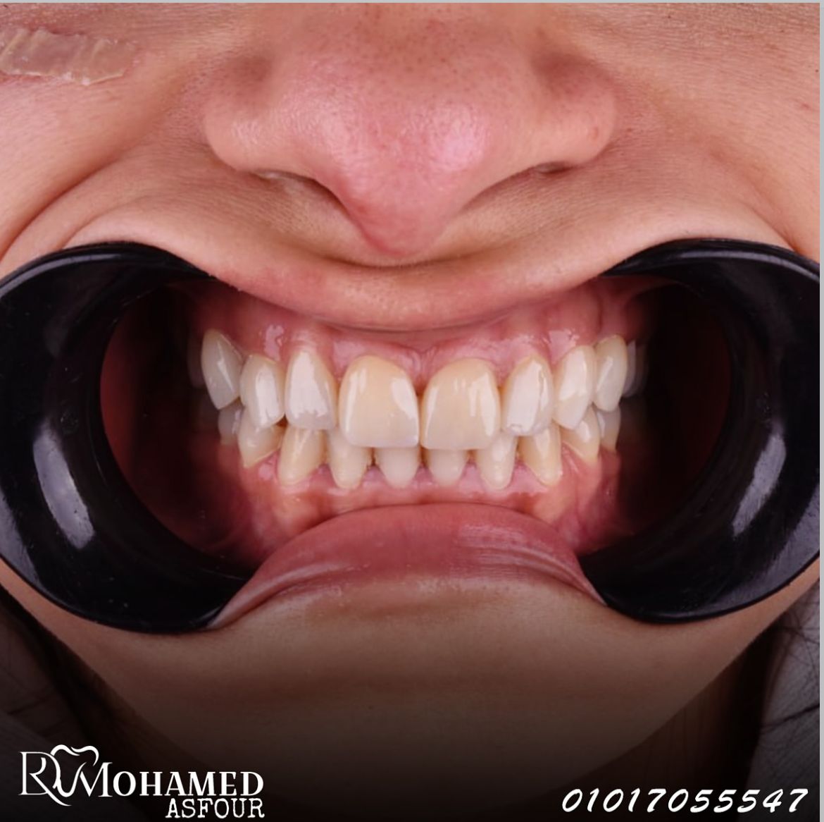 التجميل